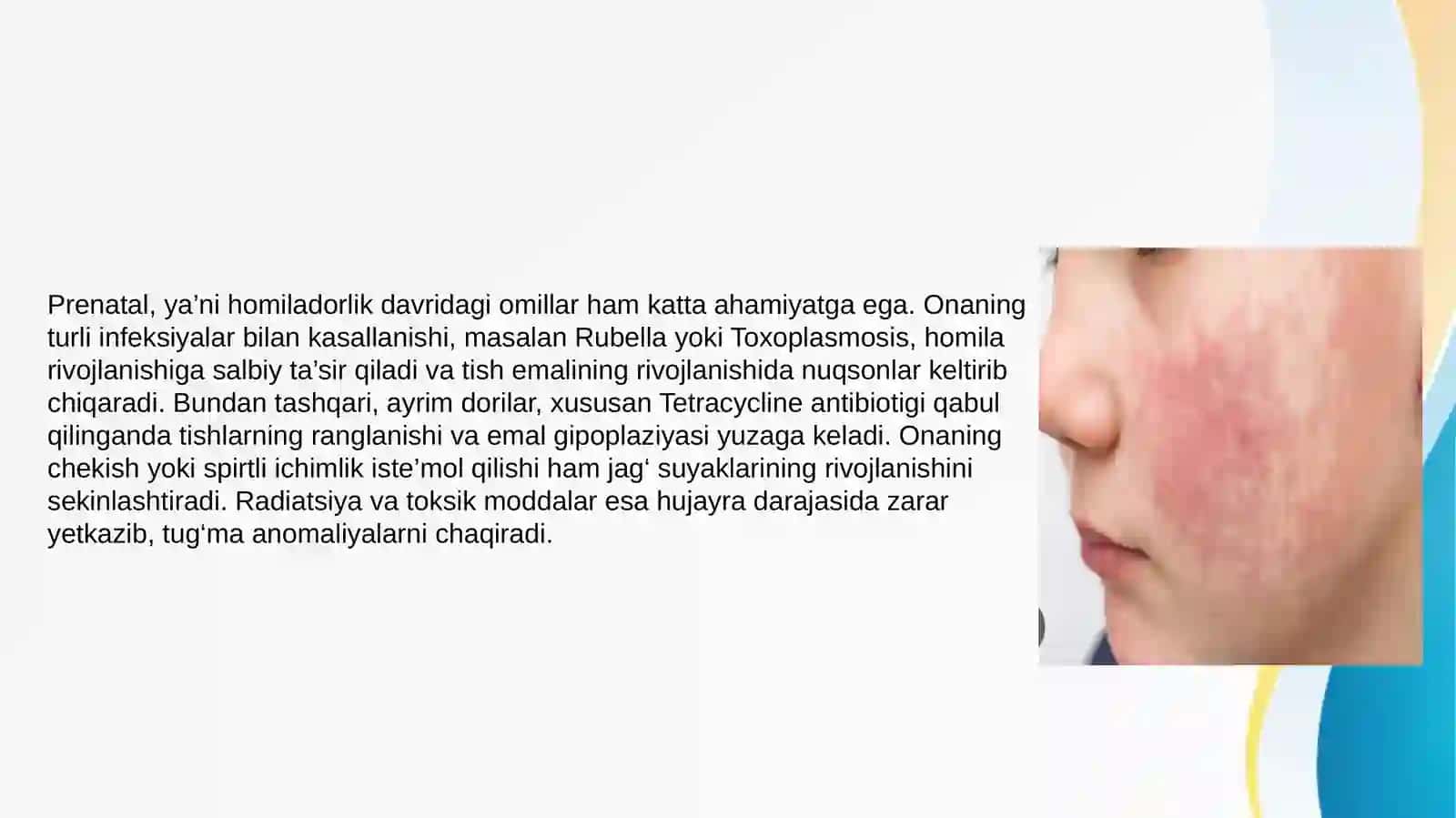 Bolalar stomatologiyasidsa anomaliya va deformatsiyalar rivojlanishi 4