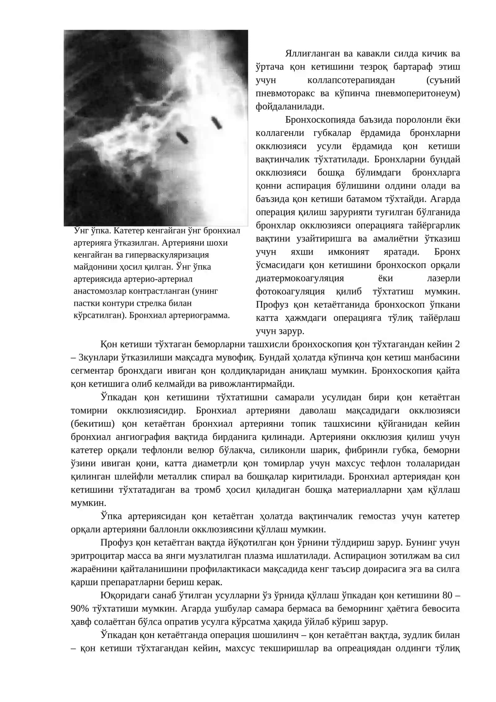 ЎПКА СИЛИДА ШОШИЛИНЧ ЁРДАМ 4
