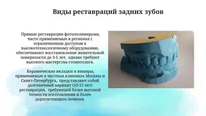 Реставрация задних зубов 4