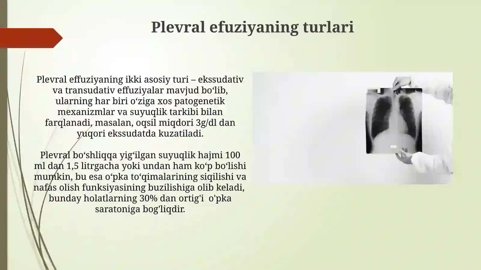 Plevral Effuziya Sindromi: Davolash va Prognozi 4