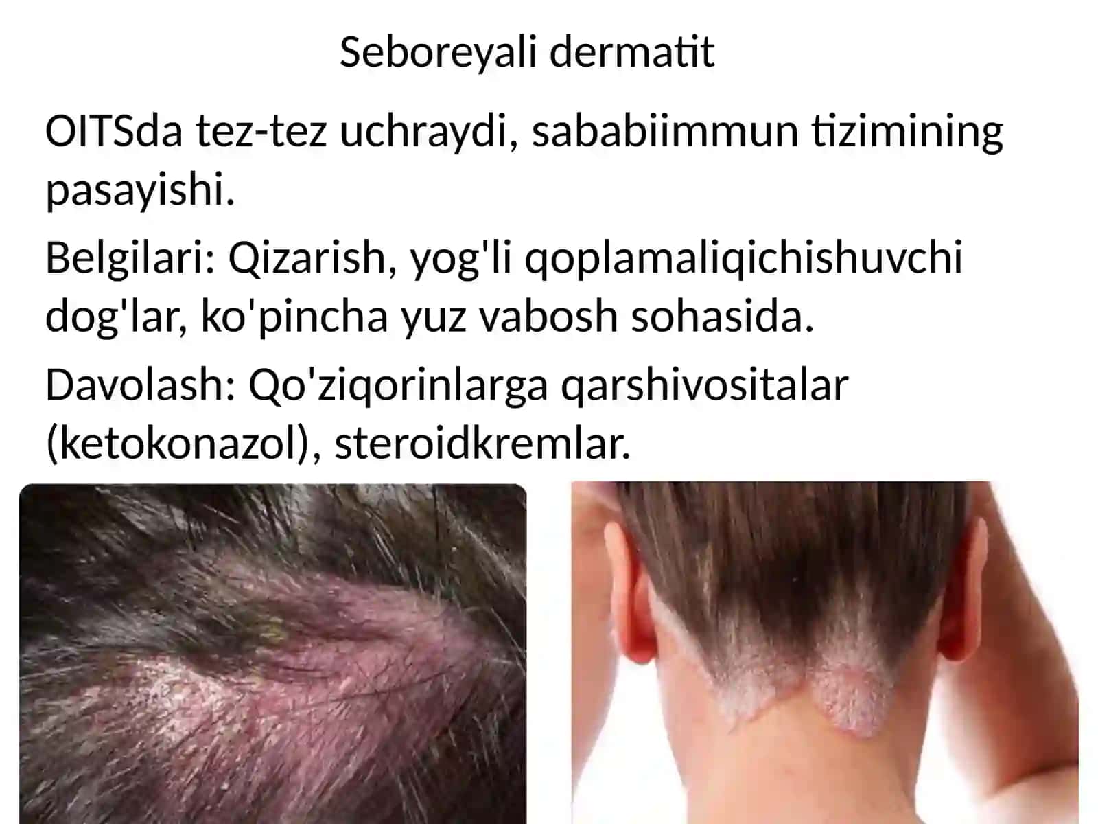 OITSda teri kasalliklari 4