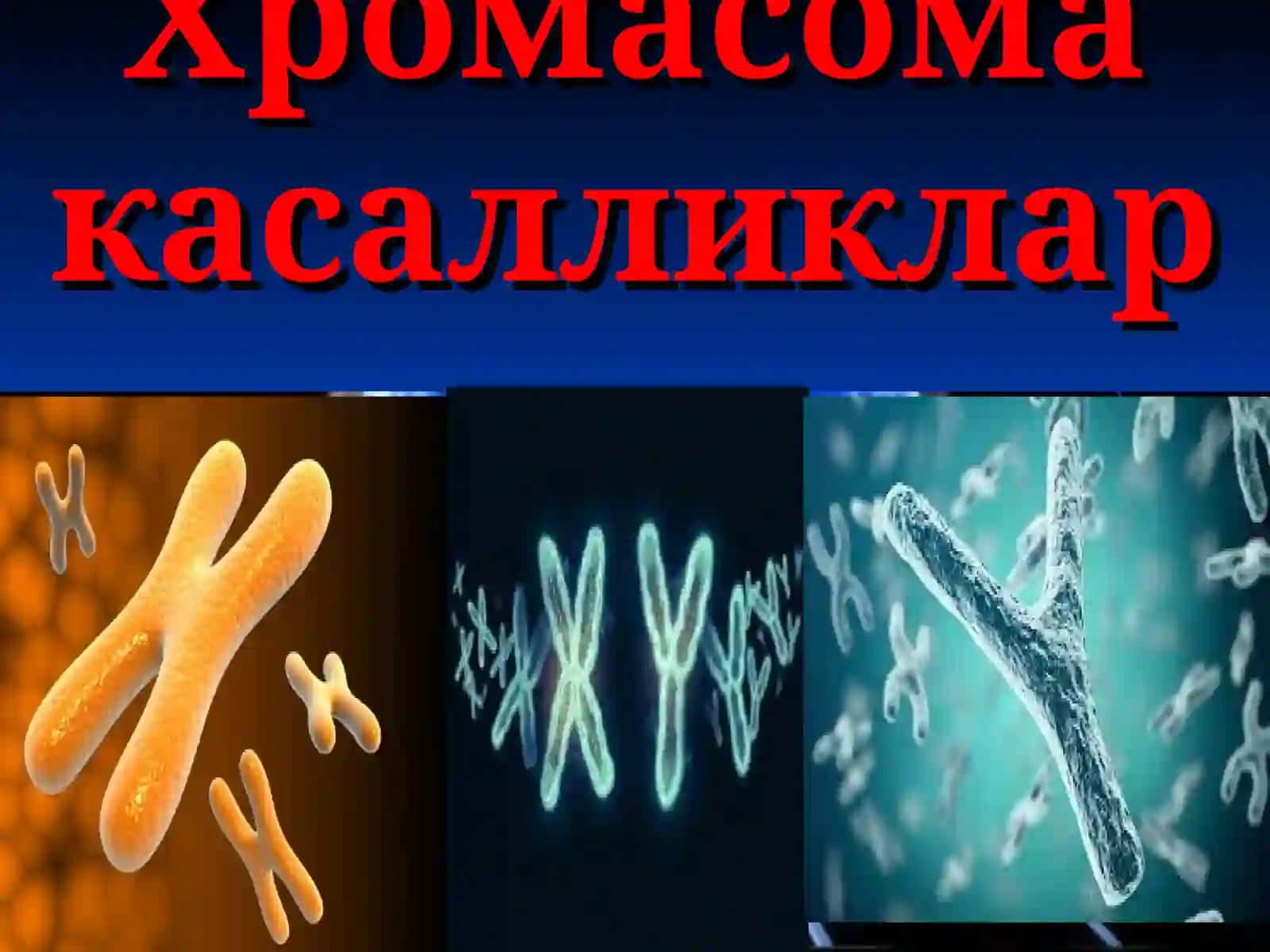 Хромосома касалликлари 4