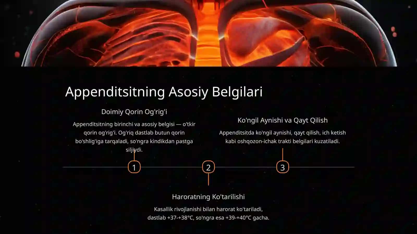 Appenditsit — Xavfli va Keng Tarqalgan Kasallik 4
