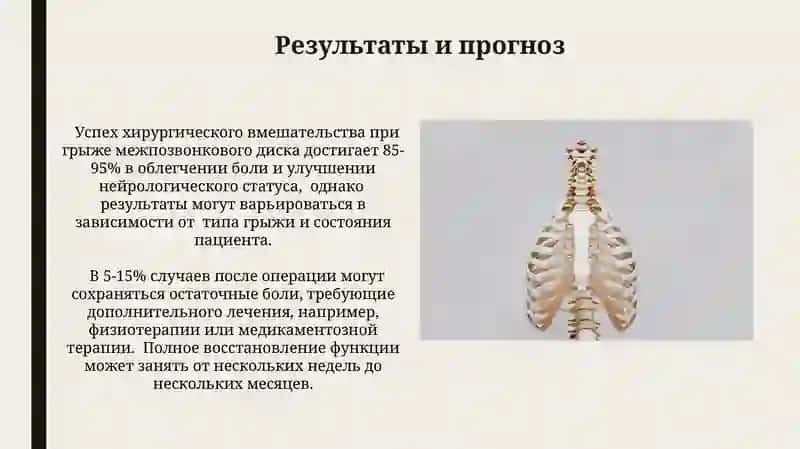 Диагностика грыжи межпозвонкового диска 4