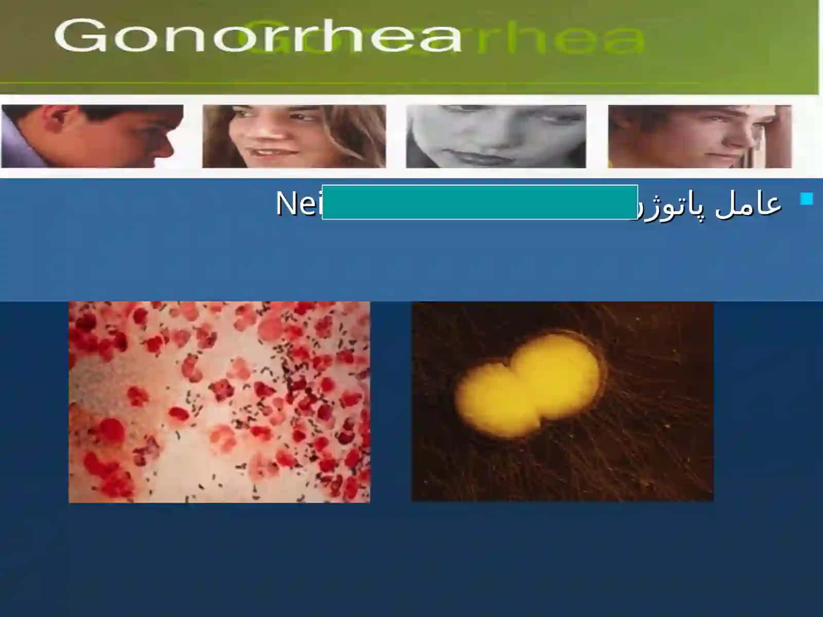 Sexually Transmitted Diseases (STD) 4