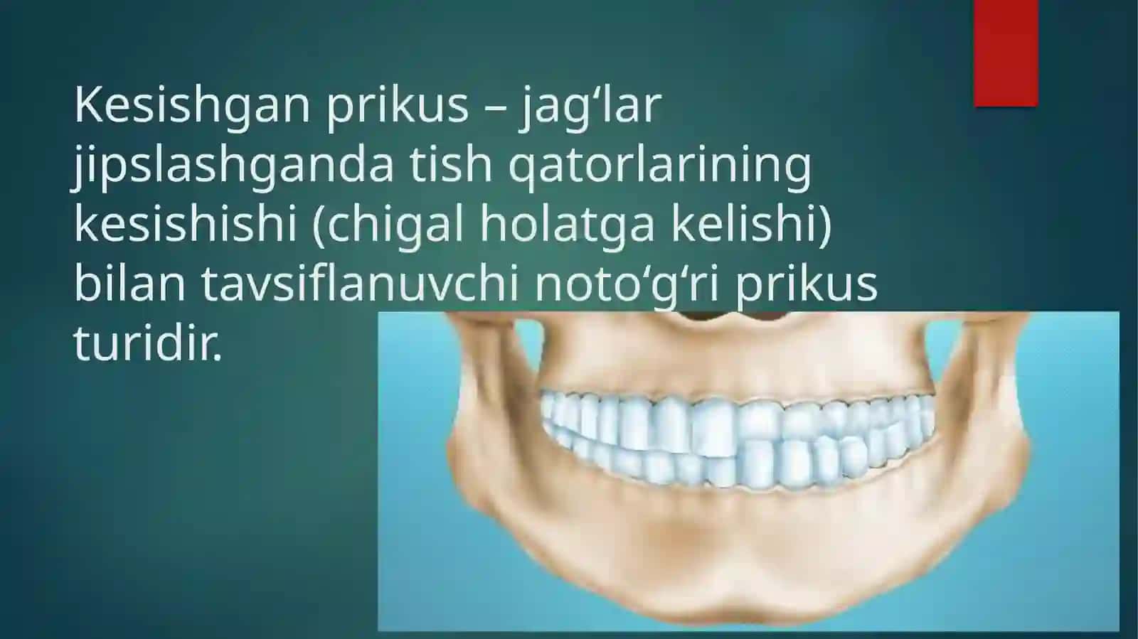KESISHGAN PRIKUS 4