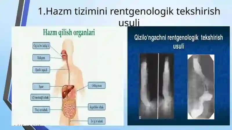 Hazmtizimii instrumental tekshirish usullari 4