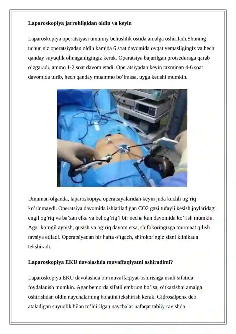 Laporoskopik operatsiyalar 4