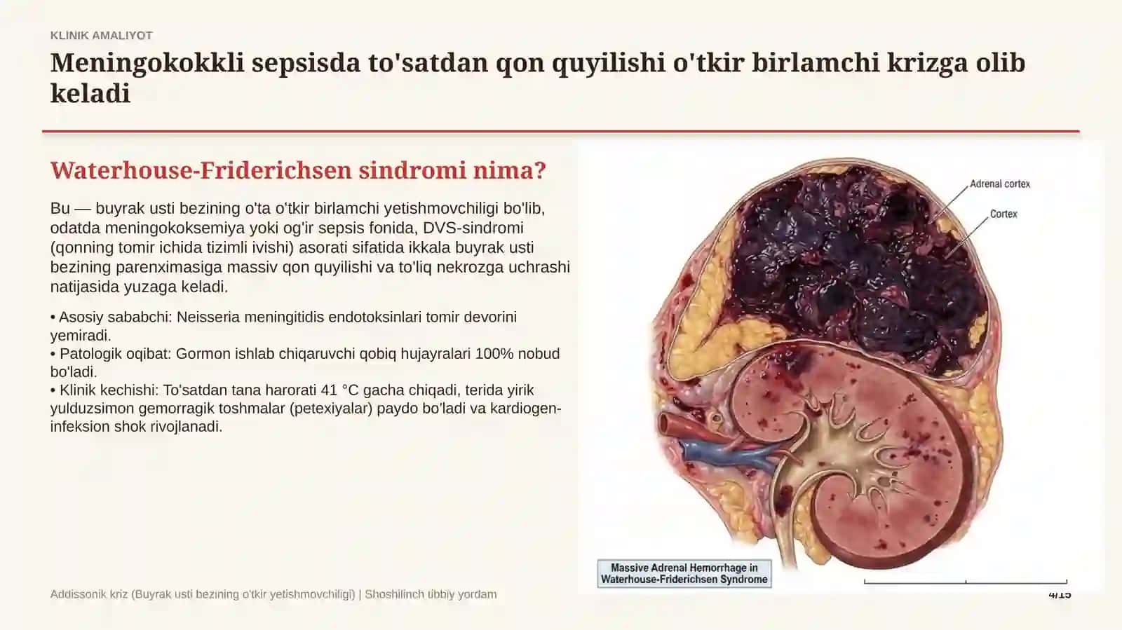 Addisonik kriz — 15 slaydli tibbiy taqdimot 4