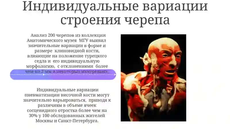 Рентгенанатомия костей черепа 4