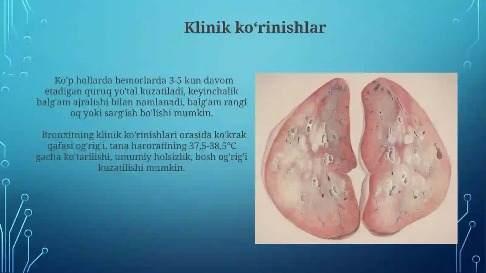 Bronhit kasalligining qo‘zg‘atuvchilari, patogenez va laboratoriya tashhisi 4
