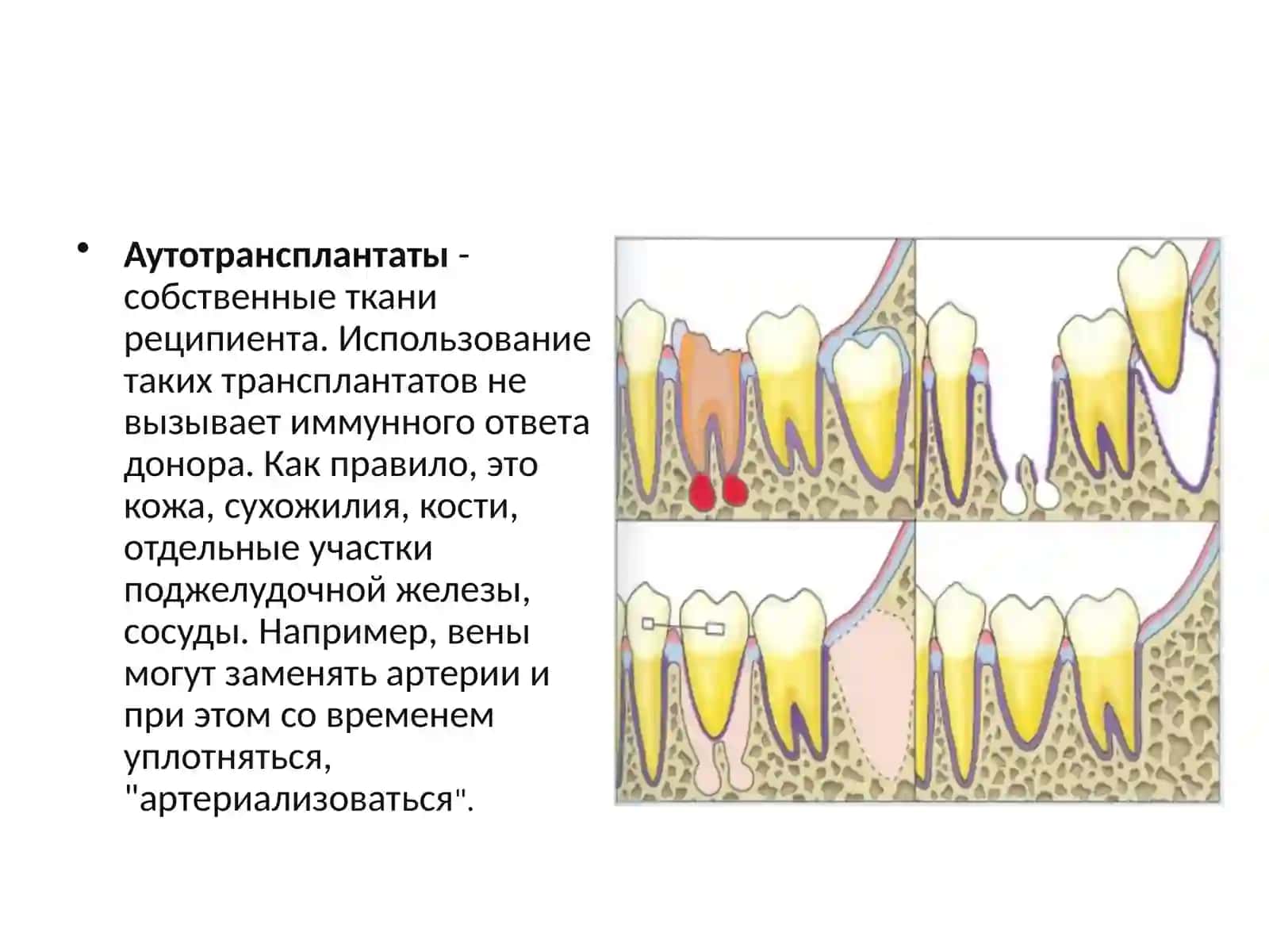 Трансплантация печени 4