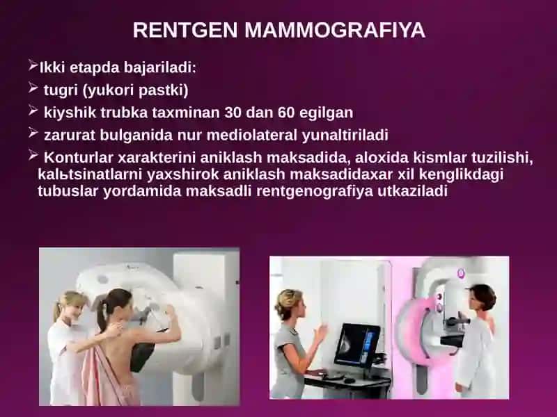 Sut bezlarini diagnostik tekshiruvusullari va kasalliklari 4