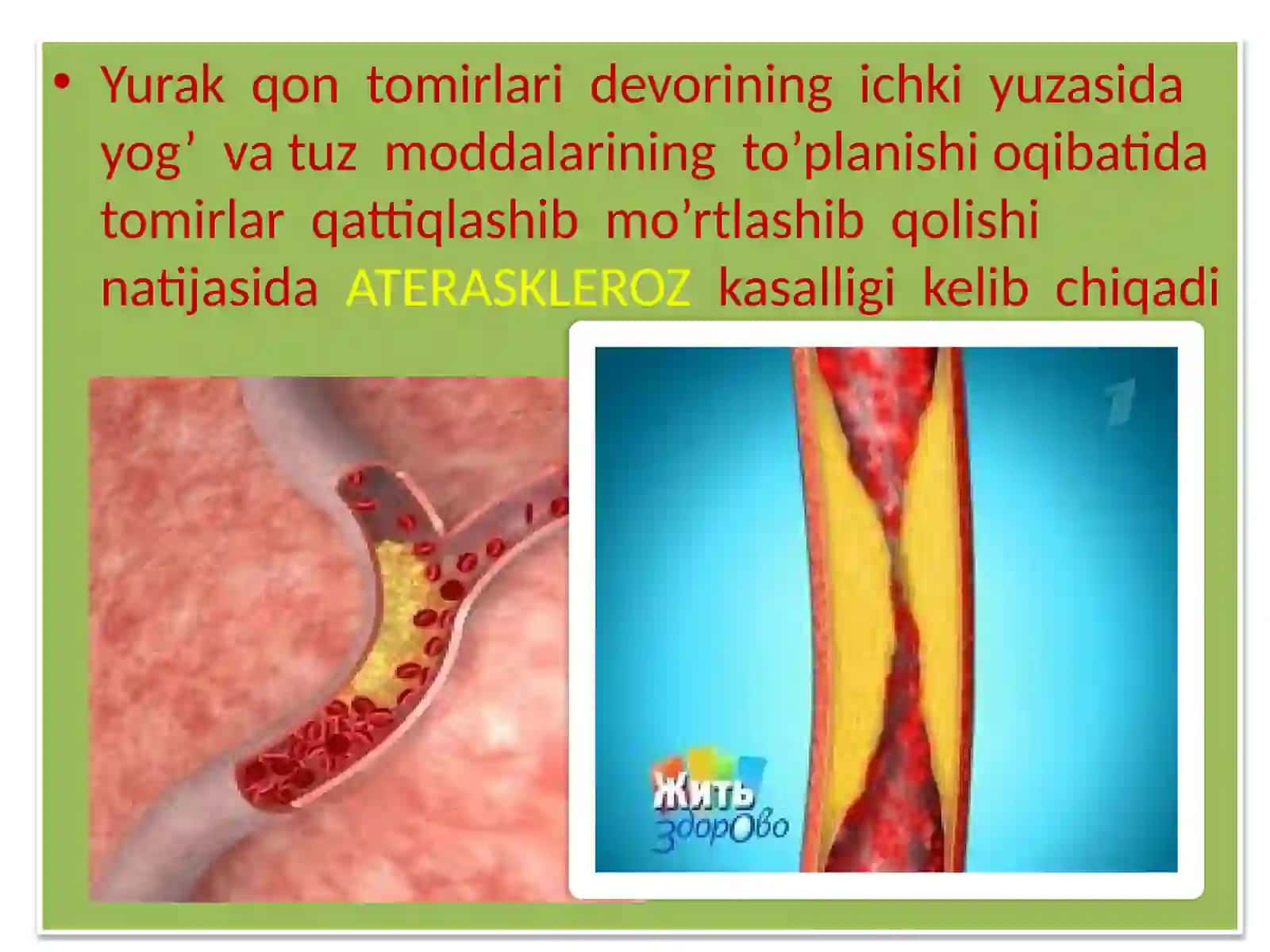 Yurak-qon tomir tizimi kasalliklari 4