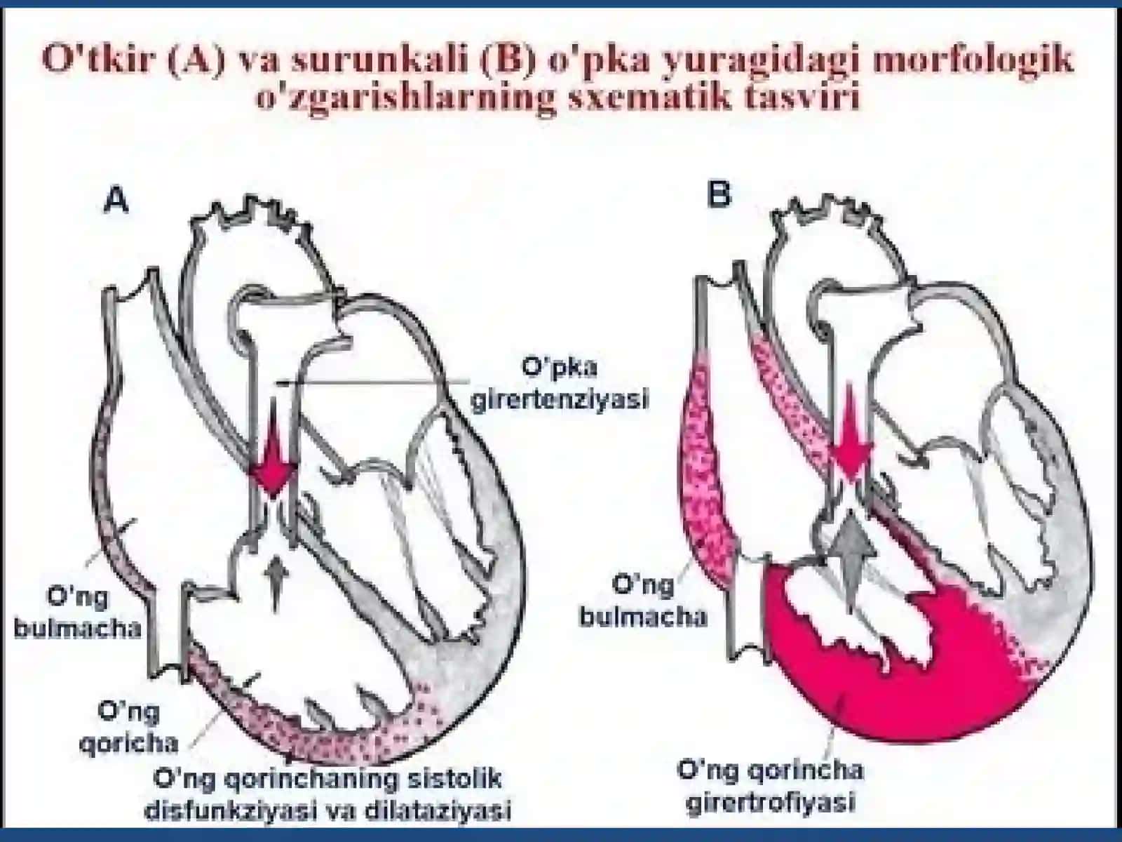 Yurako`pkareanimatsiyasiningahamiyati 4