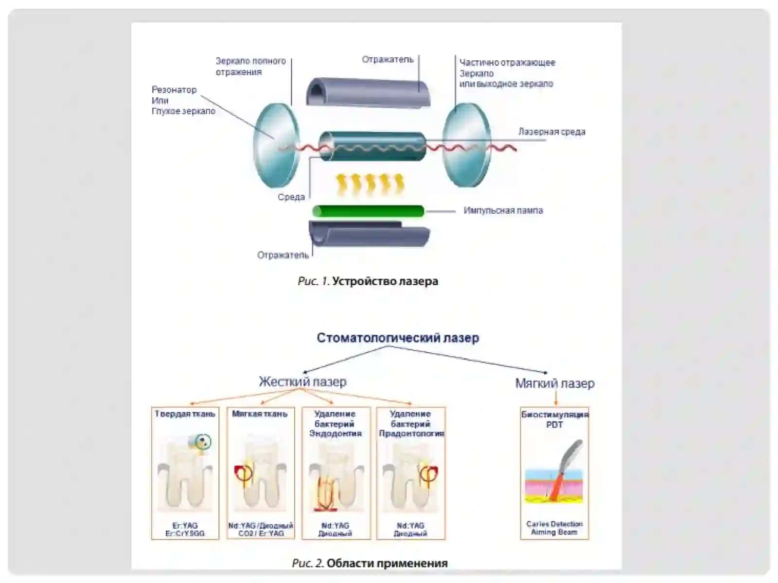 STOMATOLOGIYADA LAZER TERAPIYASI 4