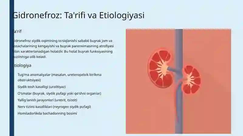 Gidronefroz Patomorfologiyasi 4