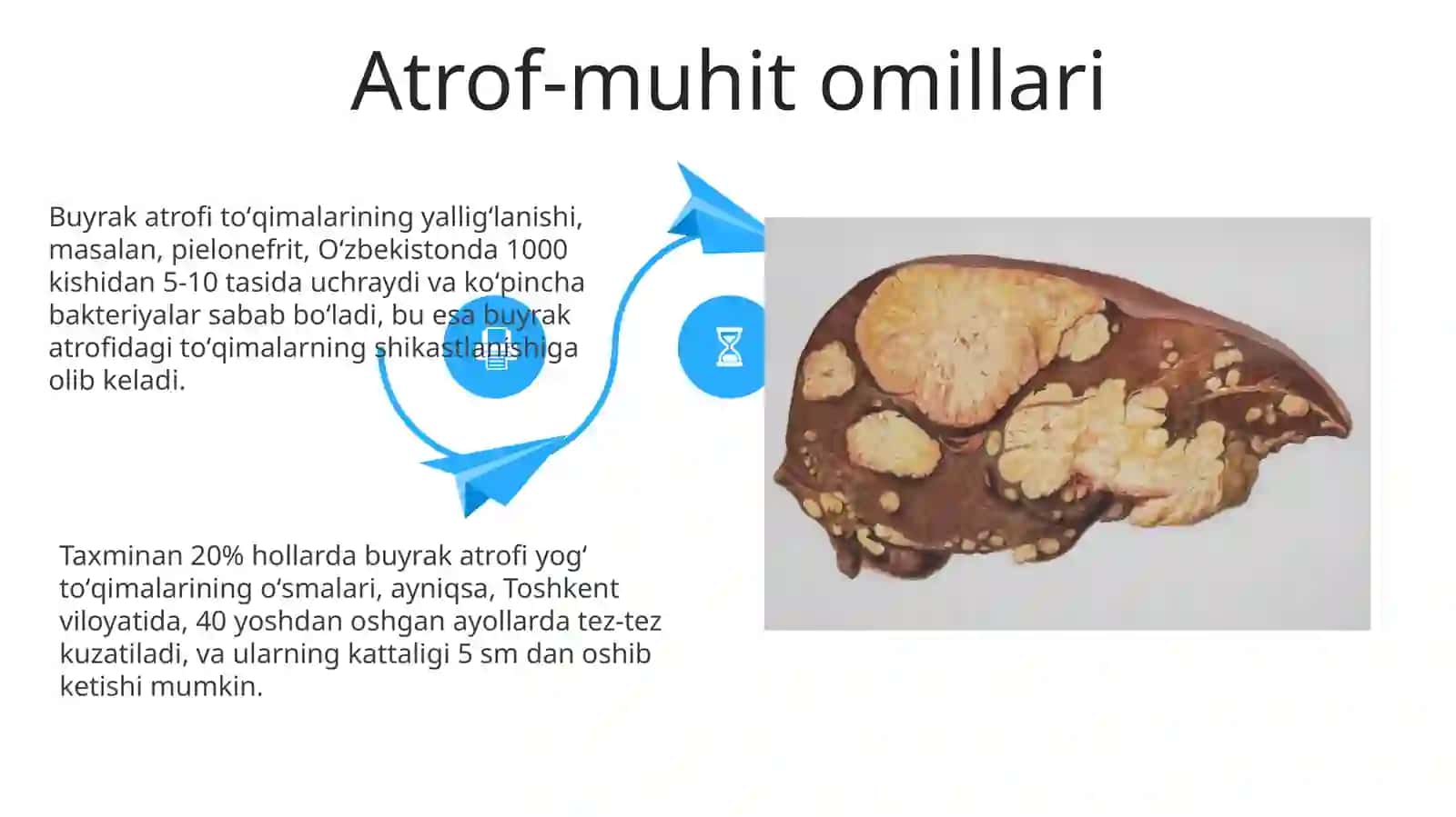 Buyrak anomaliyalari 4