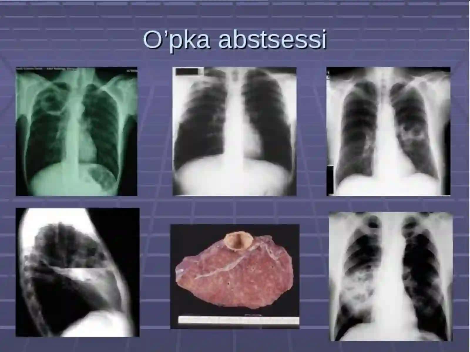 O‘kpelerabssessvagangrenasi 4