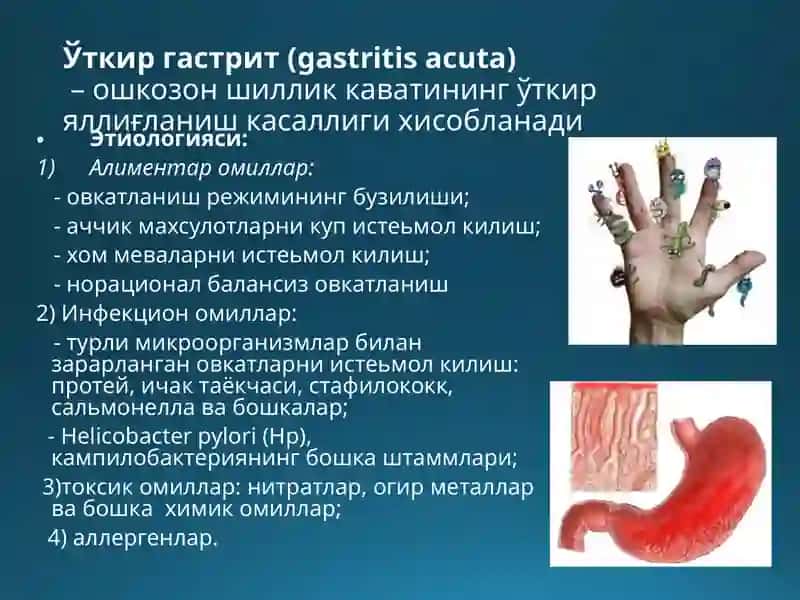 Ошқозон-ичактрактинингсурункаликасалликлари 4