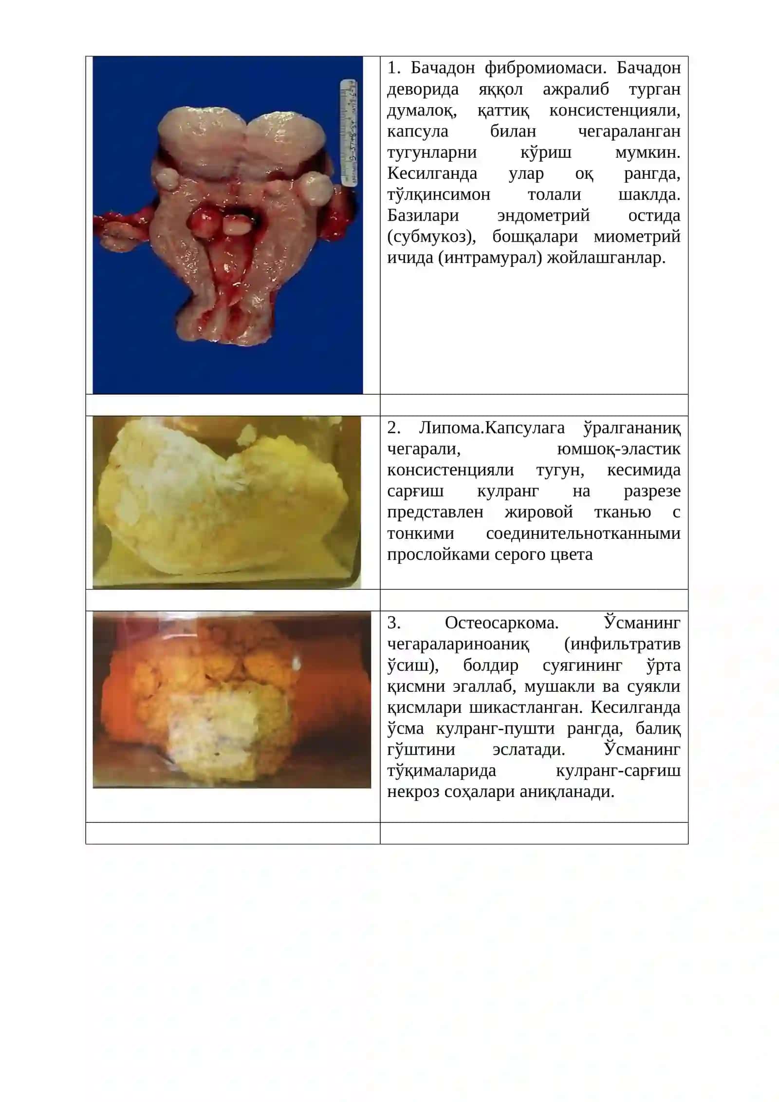 Neoplaziya va konzerogenezning molekulyar asoslari 4