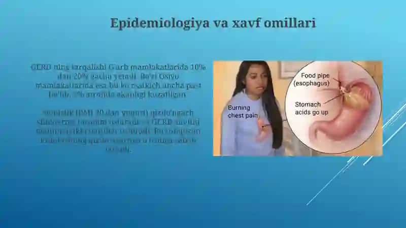 Gastroezofagial reflyuks 4