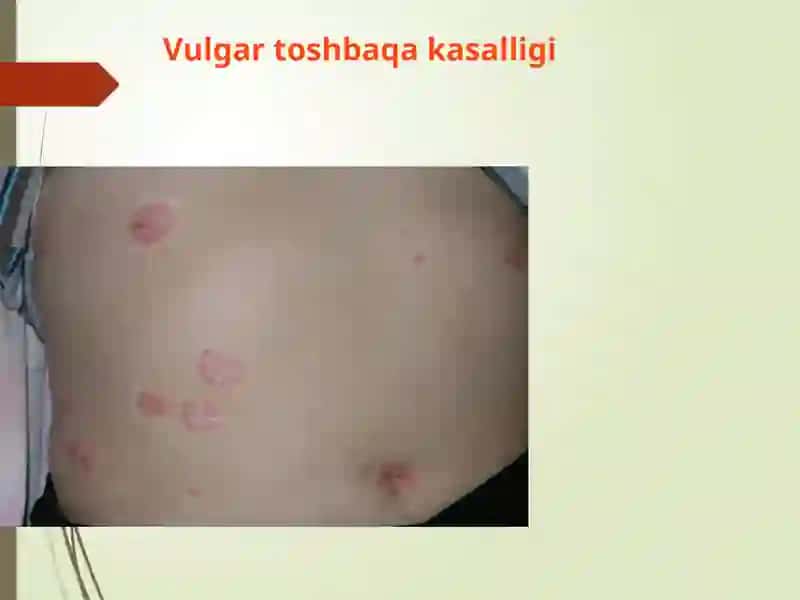 Genodermatozlar 4