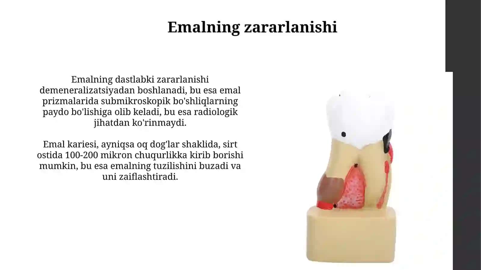Kariesni patalogik anatomiyasi 4