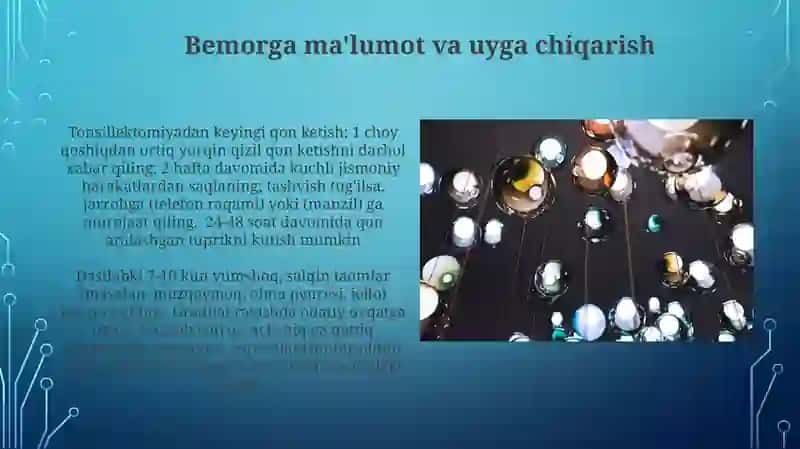 Tonsillektomiya uchun ko'rsatmalar 4