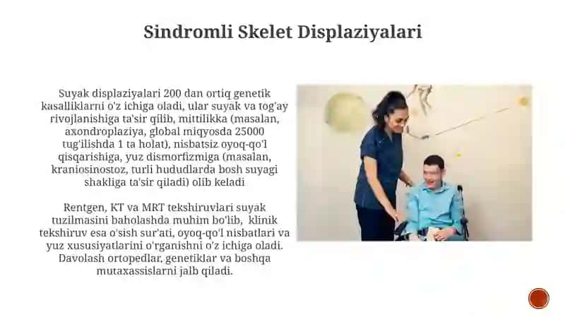 Skeletning rivojlanish anomaliyalari 4