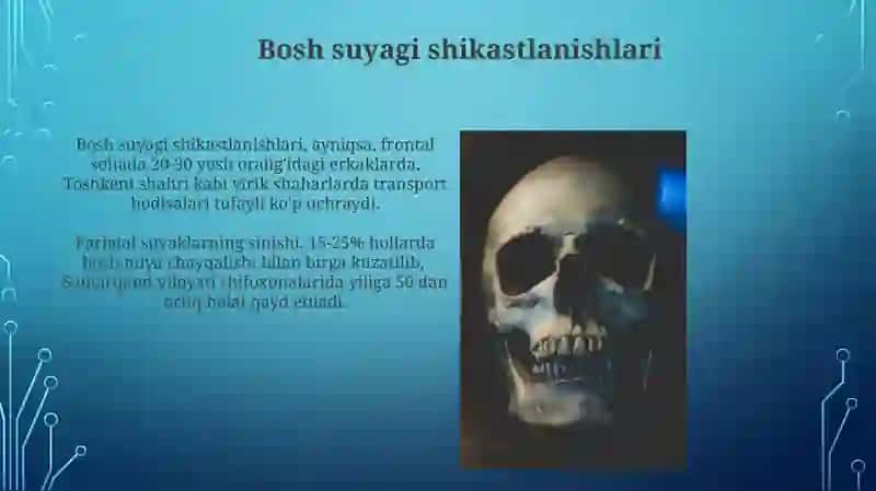 Bosh suyagi 4