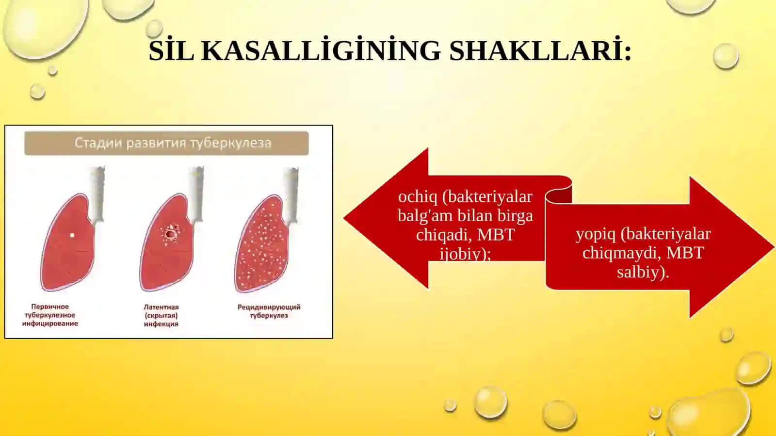 Sil kasalligıda gospital ta’limni tashkil etish 4