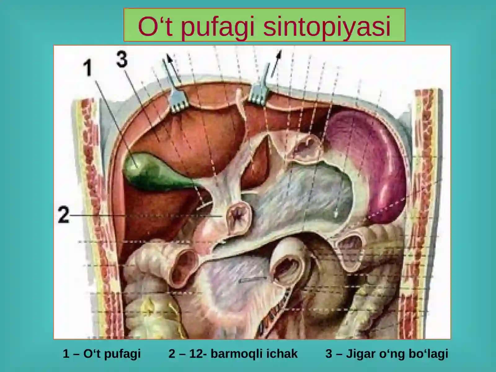 O‘t tosh kasalligi. Xoletsistitlar, diagnostikasi va davolash 4