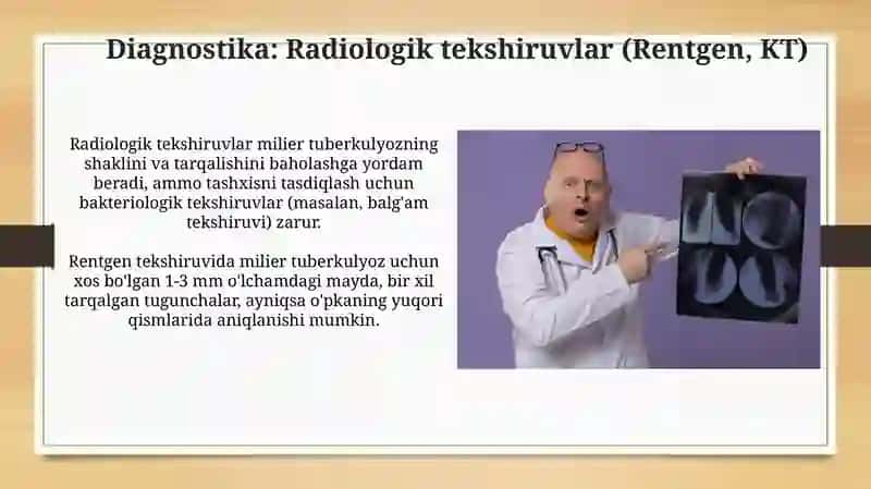 O‘pkaning tarqoq tuberkulyozi. Miliar tuberkulyoz. Klinikasi, tashxislash 4