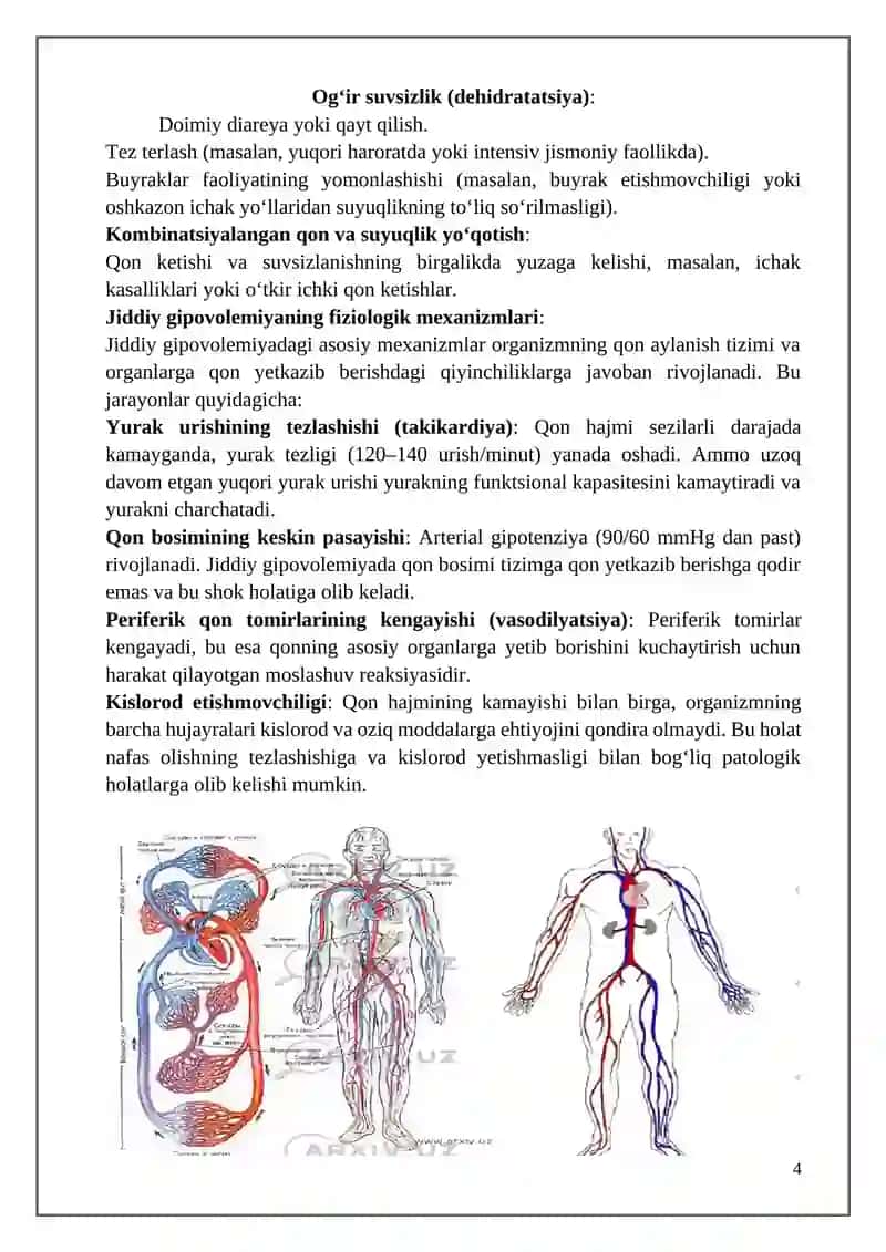 Yengil gipovolemiya 4