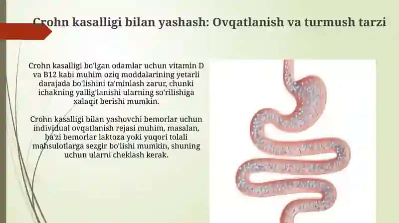 Crohn kasalligini davolash usullari 4