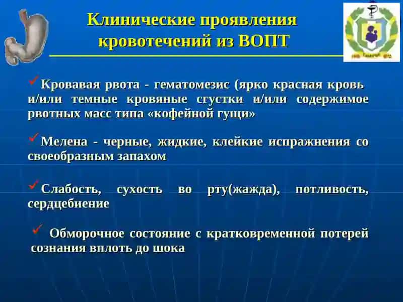 Острые желудочно-кишечные кровотечения 4