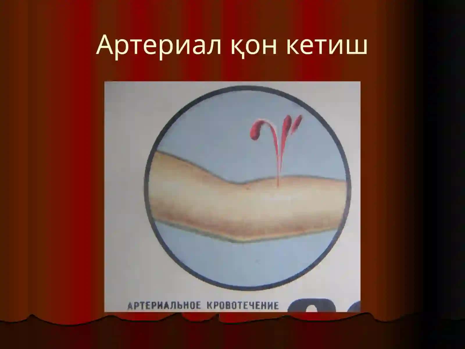 Қон кетиш 4