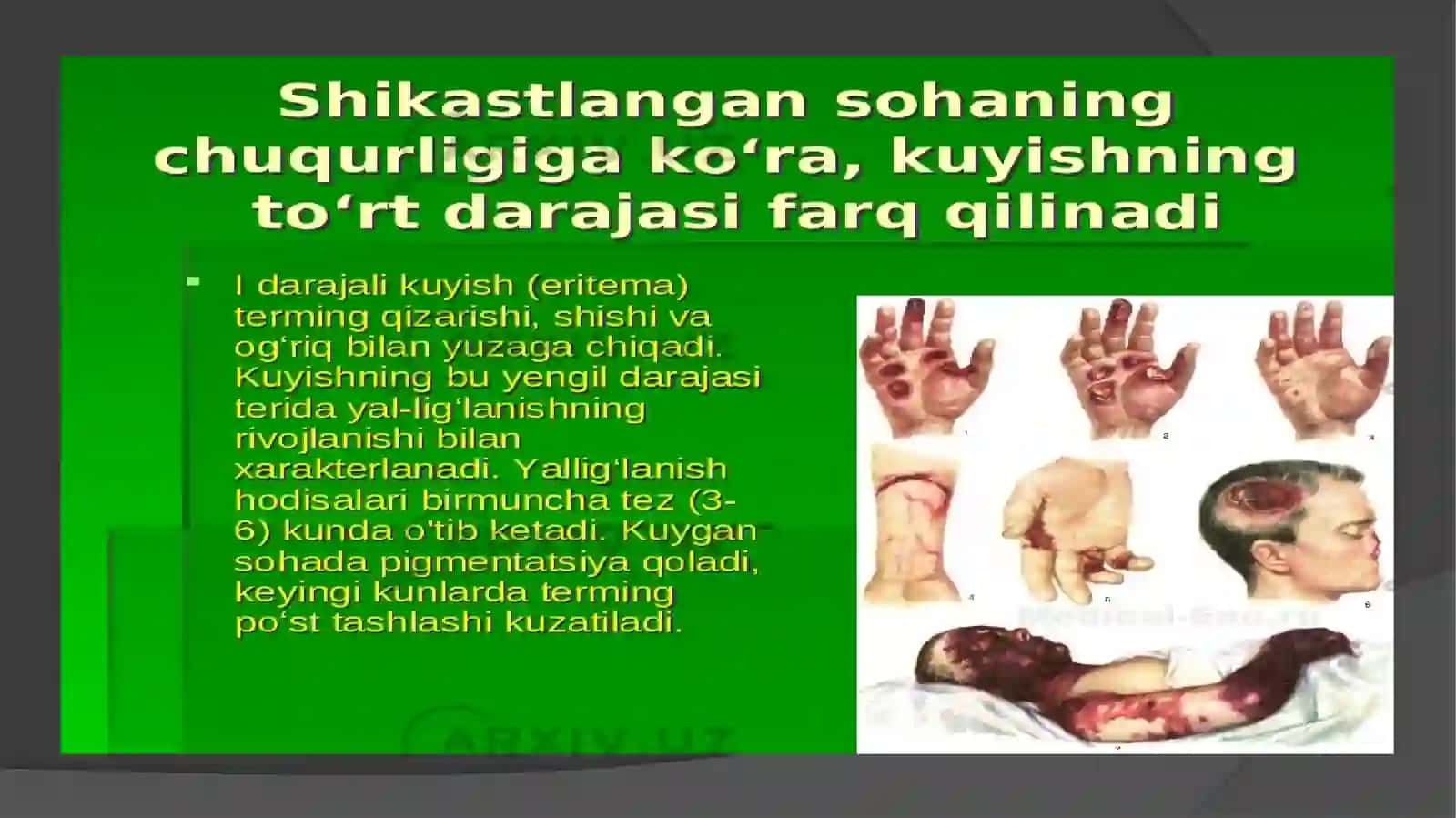 Kuyish turlari 4