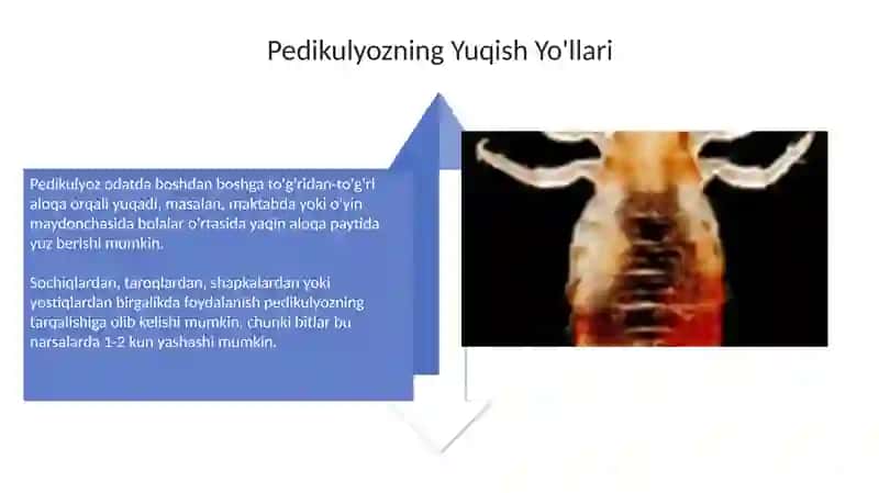 Pedikulyoz: Ta'rif va Kelib Chiqishi 4