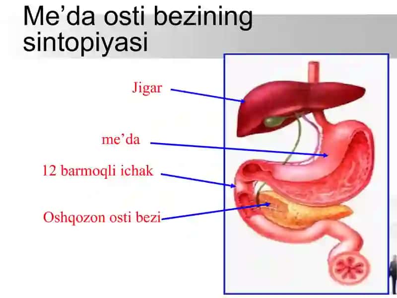 Me’da osti bezi kistalari va oqmalari 4