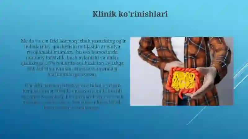 Oshqozon va o'n ikki barmoq ichak yarasi kasalligi 4