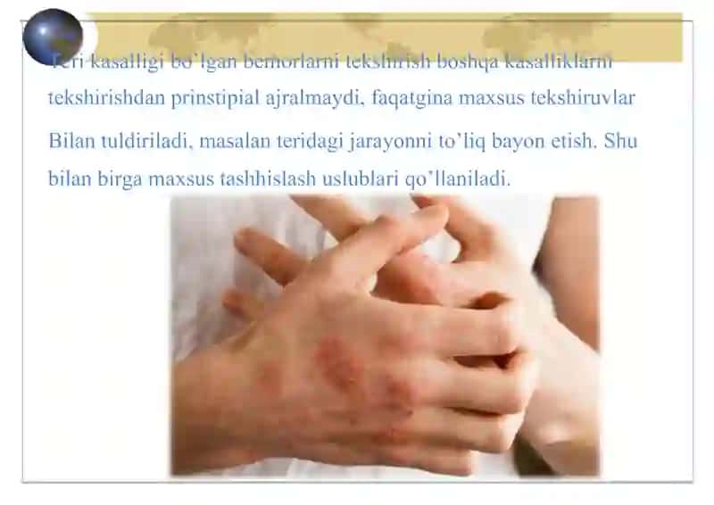 Dermatozlar nasliy kasalliklari 4