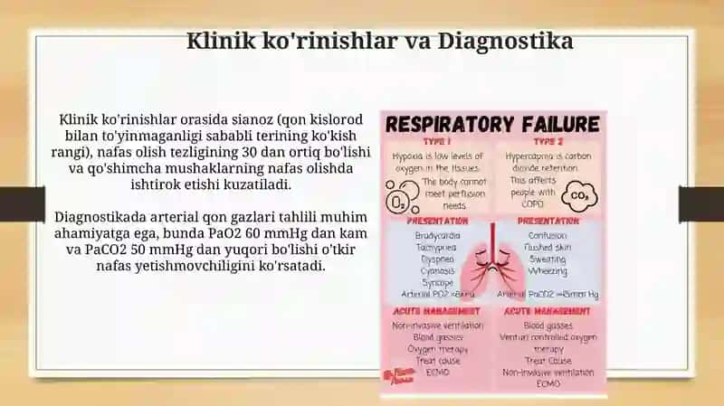 O'tkir nafas yetishmovchiligi 4