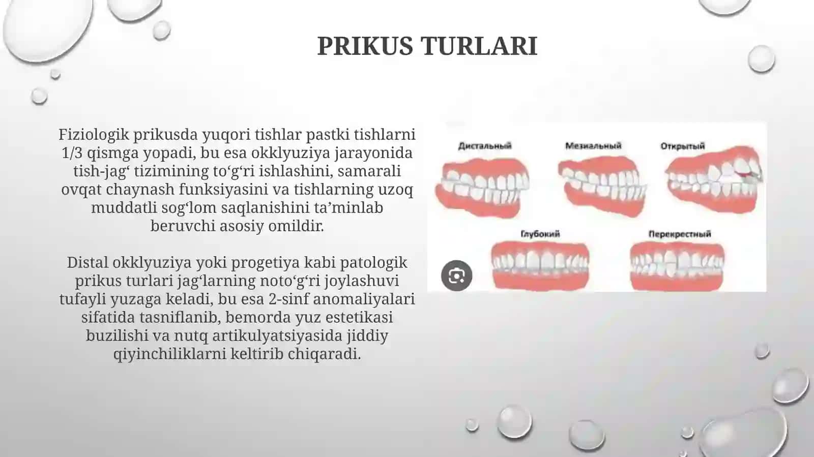 Prikus 4