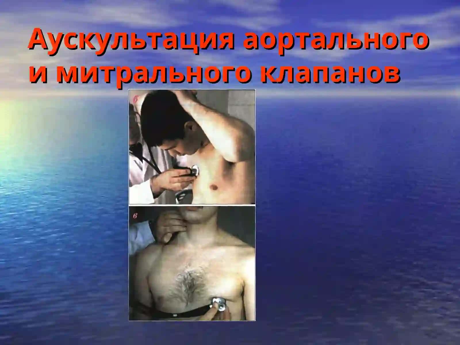 Аускультация сердца.Тоны сердца. Сердечные шумы 4