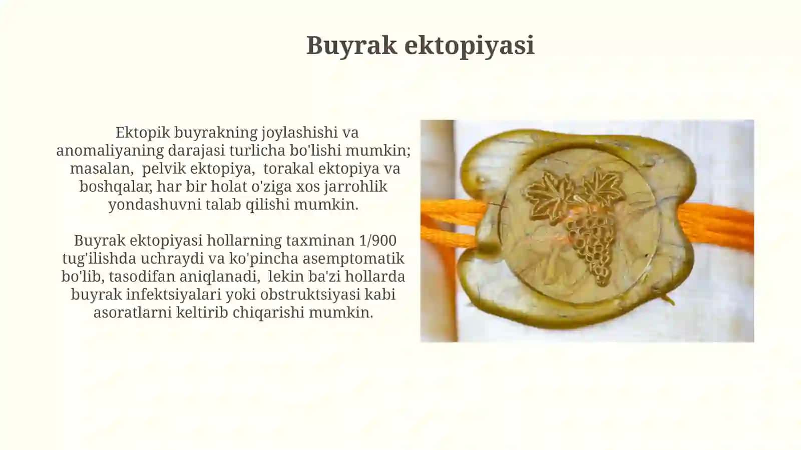 Buyraklarning tug'ma va orttirilgan nuqsonlarinidavolash 4