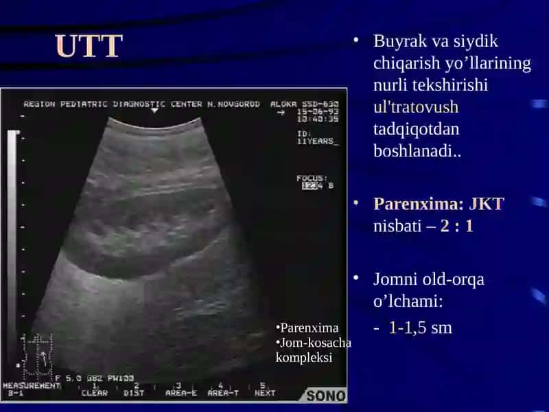 BUYRAK VA SIYDIK YO’LLARI KASALLIKLARININING NUR DIAGNOSTIKASI 4
