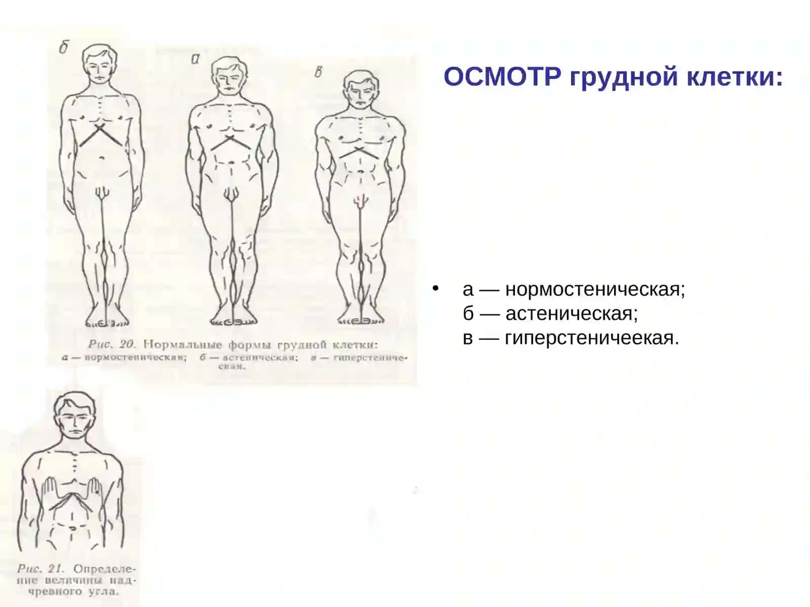 Осмотр грудной клетки Патологические 4