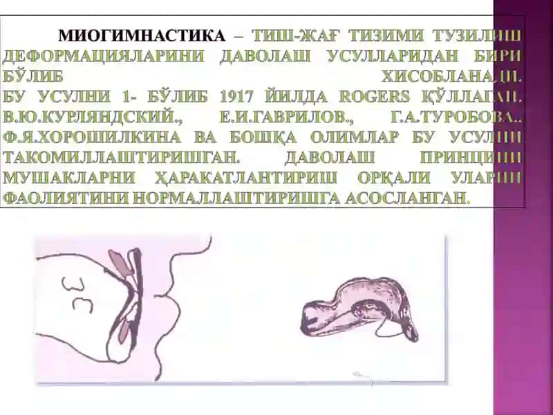 Ортодонтикдаволашнинг асосийтамоиллари 4